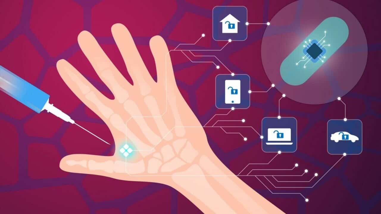 Computadores do futuro implantados no corpo humano
